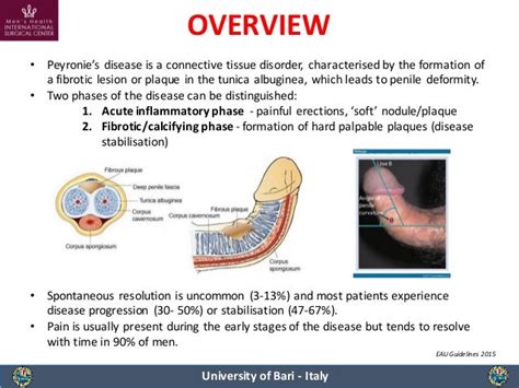 Peyronie disease